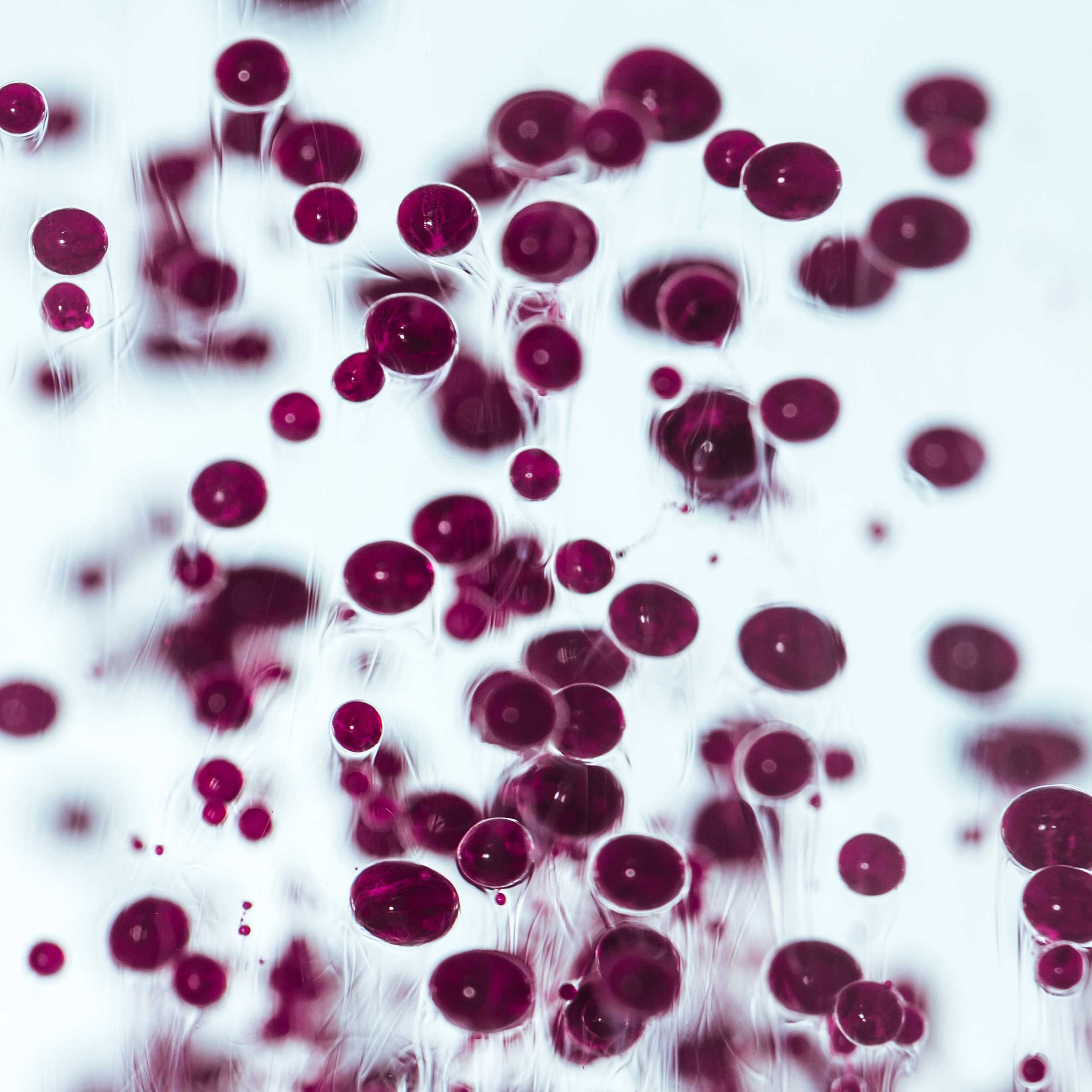Basal-Cell-Carcinoma