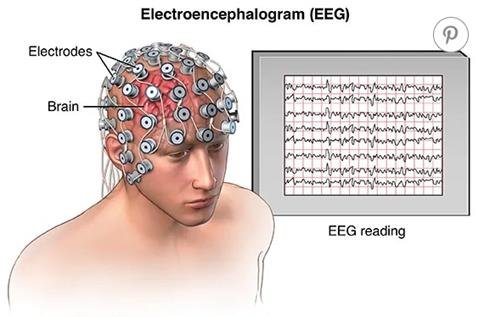 EEG